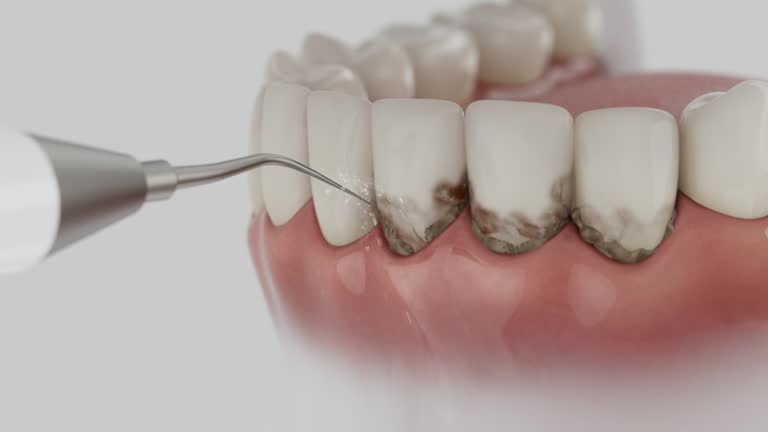 Reliable Tooth Extraction contractor in Onsted, MI by Smile Center Dentistry
